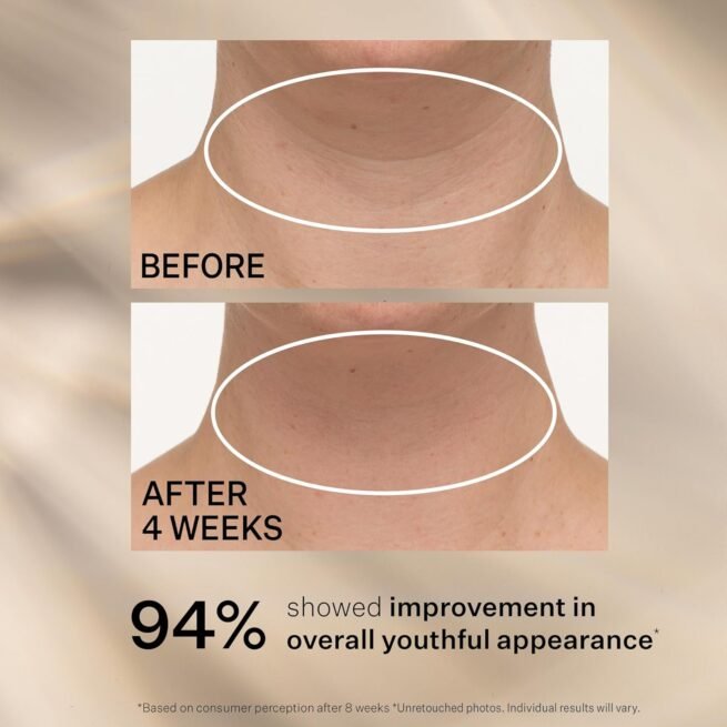 StriVectin StriVectin Tighten & Lift Advanced Neck Cream PLUS com Peptídeos™ Alfa-3 para Pescoço & Decote, Aparência suavizante de rugas e linhas finas, melhora a pele crepe & linhas verticais, para uma pele suave e suave.